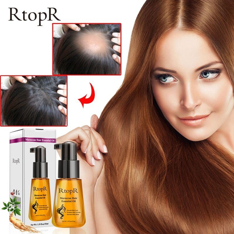 Moroccan Prevent Hair Loss Product Hair Growth Essential - GearBeauty